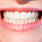 Prześliczne urodziwe zęby również powalający cudny uśmiech to powód do zadowolenia.
